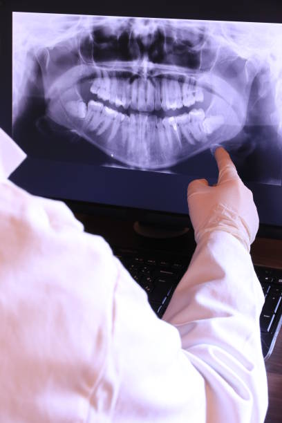 Best Emergency Cosmetic Dentistry (e.g., broken veneers) in Riverdale, NJ