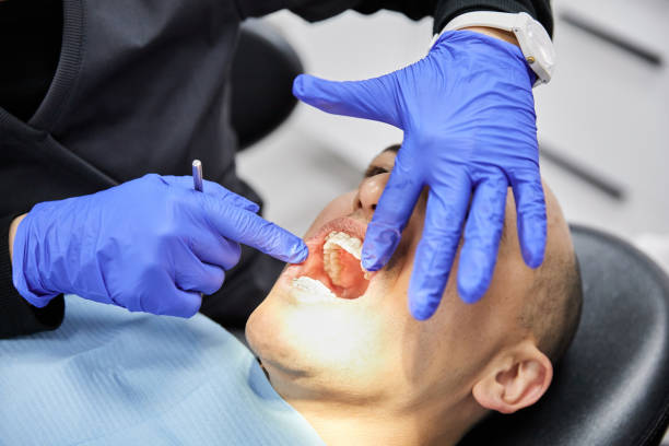 Best Emergency Wisdom Tooth Extraction in Riverdale, NJ